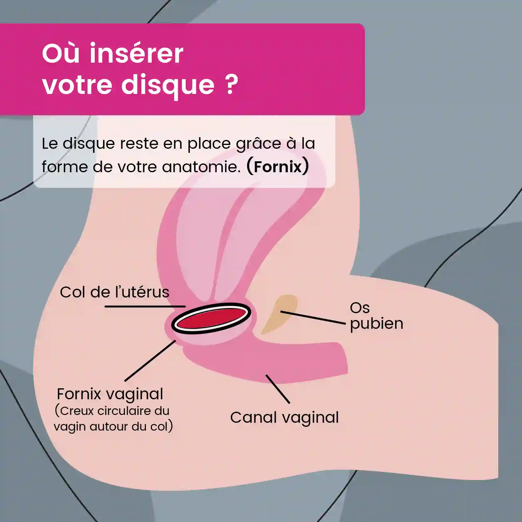 mypads-disque-menstruel-r-utilisable-compatible-rapports-p-n-tratifs image 3